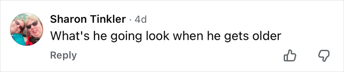 Comment by Sharon Tinkler questioning appearance after aging, related to man who got his eyeballs tattooed revealing dangerous process. Comment by Sharon Tinkler questioning appearance after aging, related to man who got his eyeballs tattooed revealing dangerous process.