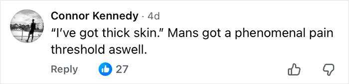 Comment by Connor Kennedy about a man with a high pain threshold who got his eyeballs tattooed, discussing the dangerous process. Comment by Connor Kennedy about a man with a high pain threshold who got his eyeballs tattooed, discussing the dangerous process.