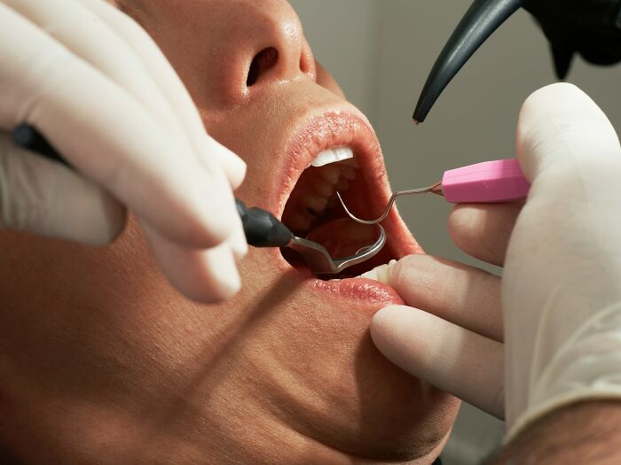 Close-up of a dental procedure with dentist’s gloved hands using tools inside a patient’s open mouth during an exam.