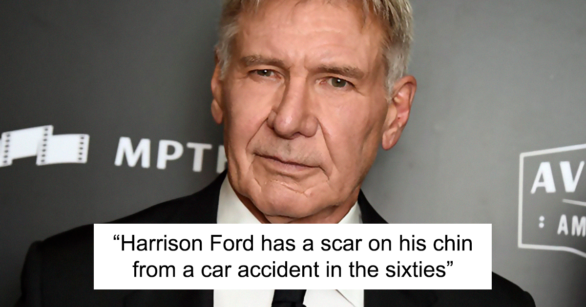 22 Celebrities That Have Visible Scars And The Stories Behind Them
