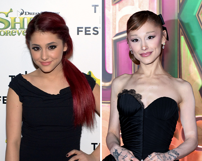 Side-by-side photos of Ariana Grande showing a dramatic transformation sparking concerns over tons of surgery.