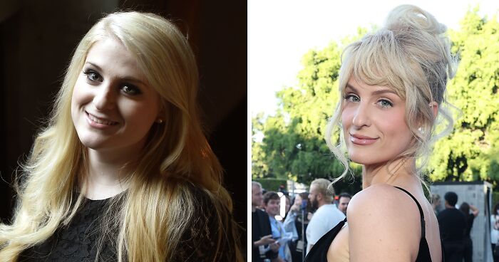 Meghan Trainor’s “Before And After” Photos Reveal More Than Just Weight Loss