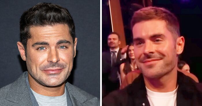 Zac Efron’s ‘Back to Normal’ Face Has Everyone Talking As Expert Weighs In On What Happened
