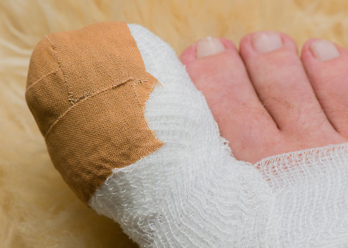 Close-up of a bandaged toe wrapped in gauze and medical tape, illustrating unusual ER stories and treatments.