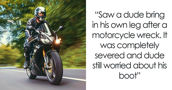 “Her Face Ripped Off”: 49 Most Bizarre Medical Cases Medical Workers Saw In The ER