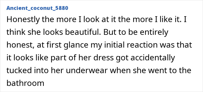 Comment describing Jennifer Lawrence's diaper dress look amid rising plastic surgery speculation in entertainment news.