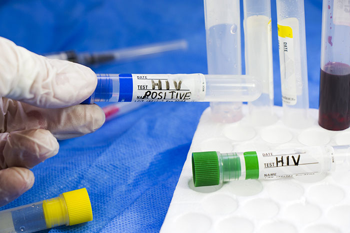 Gloved hand holding test tube labeled HIV positive with other medical test tubes on blue surface, highlighting doctors mistakes.