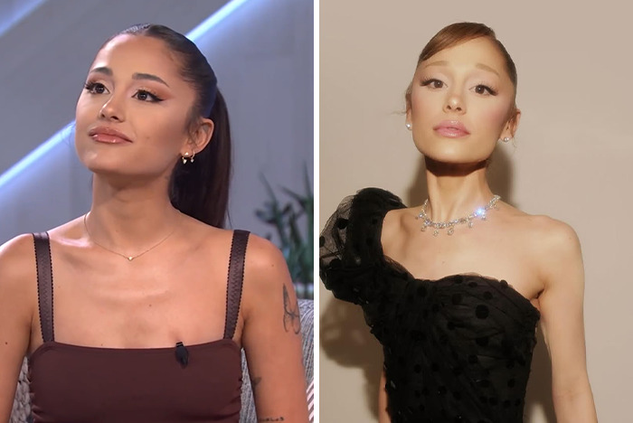 Split image showing a woman before and after a transformation highlighting extremely thin and worrying appearance changes. Split image showing a woman before and after a transformation highlighting extremely thin and worrying appearance changes.