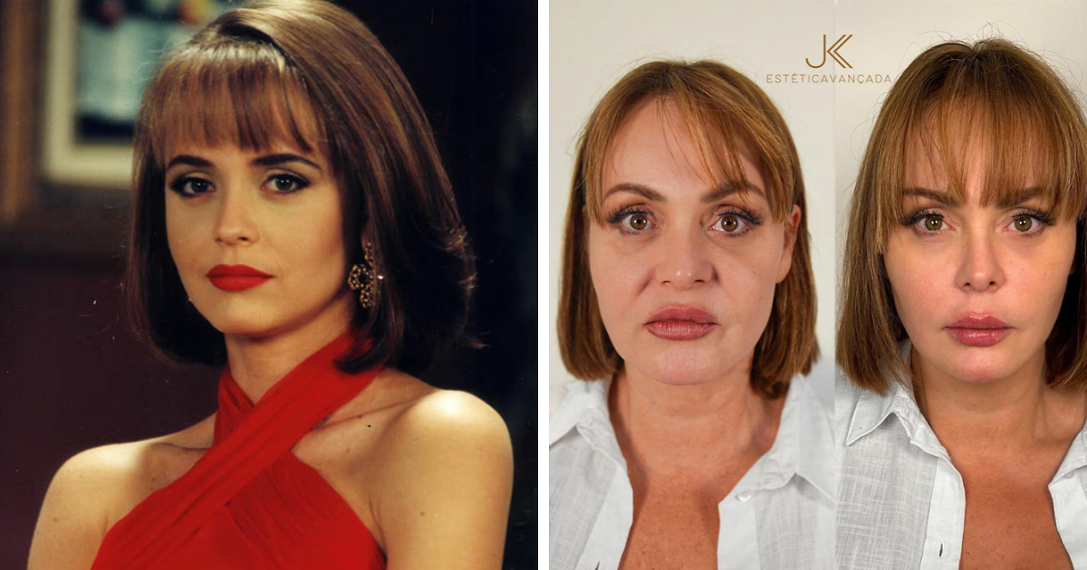 Gaby Spanic's 'Unrecognizable' BeforeAfter Plastic Surgery Pictures
