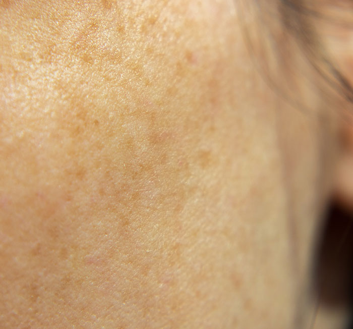Close-up of a woman&rsquo;s cheek showing small freckle tattoos on her skin after impulsive decision.