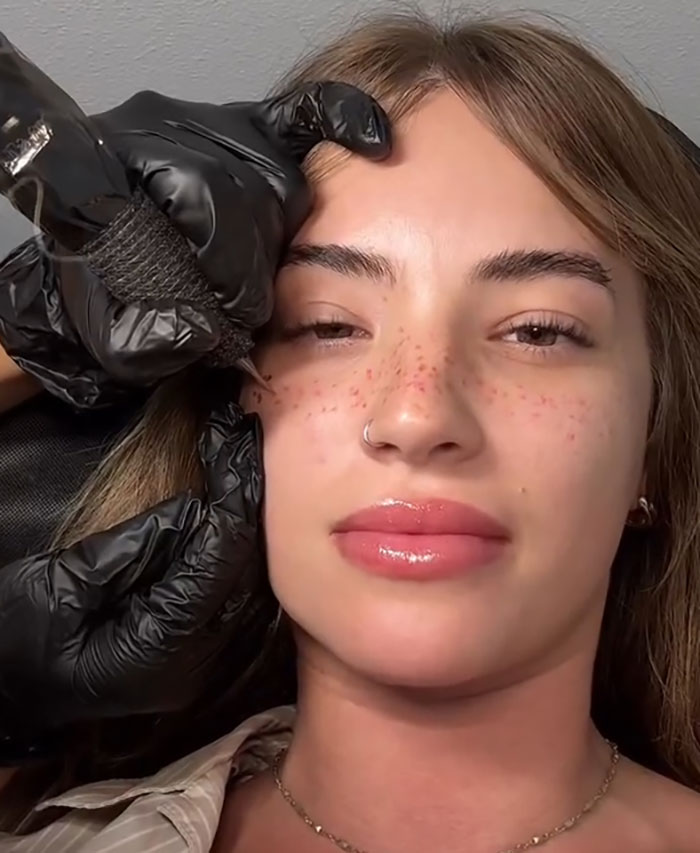 Woman getting freckles tattooed on her face by a professional artist wearing black gloves in a close-up beauty procedure.