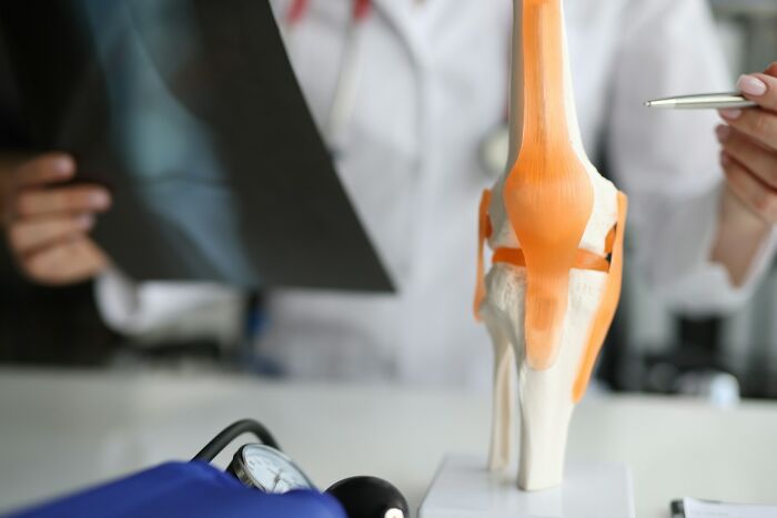 Doctor reviewing x-ray with knee joint model and blood pressure monitor in medical office illustrating work secrets