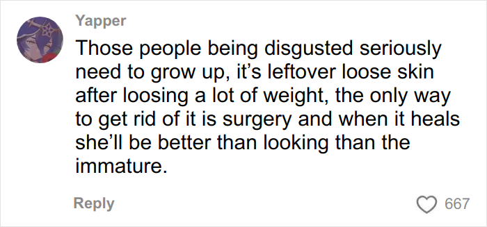Comment about leftover loose skin on belly after massive weight loss and surgery as a solution to improve appearance