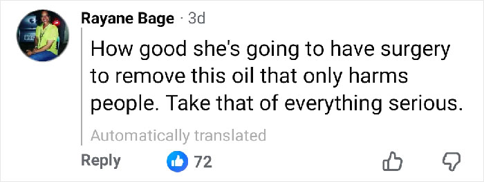 Comment on social media about influencer disfigured in botched plastic surgery undergoing new operation to restore her look.