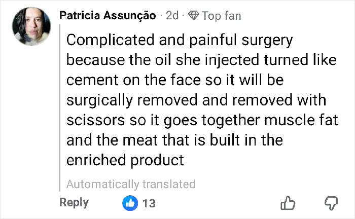 Comment explaining the complicated surgery to remove cement-like injected oil from influencer&rsquo;s face after botched plastic surgery.