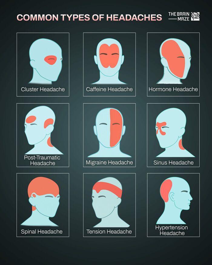 Diagrams showing common types of headaches with highlighted pain areas related to the human body facts and health.