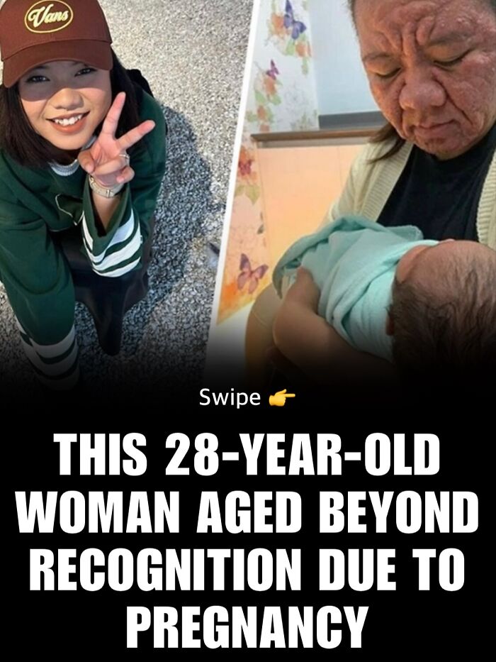 Split image showing a 28-year-old woman before and after pregnancy, illustrating aging effects for daily facts and interesting stories.