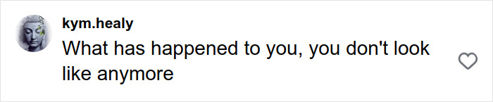 Comment on social media post criticizing appearance, referencing stretch marks on your skin in a public discussion.