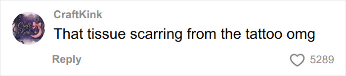 Comment about tissue scarring from a tattoo, reacting to a claim about a skinned body display in a Las Vegas museum.