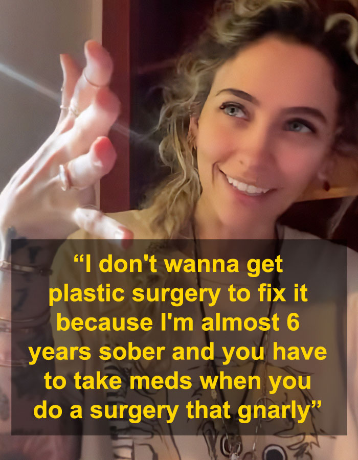 Smiling woman with curly hair shares experience of how substance use deformed her face and affects plastic surgery choices.