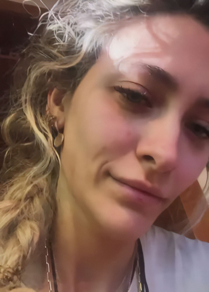 Close-up of Paris Jackson showing effects of substance use that deformed her face, with natural lighting and relaxed expression.