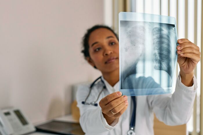 Doctor analyzing a chest X-ray in a medical office, illustrating themes of brutal revenge on an ex with zero regrets.