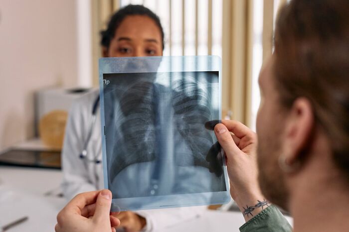 Patient reviewing chest X-ray with doctor, illustrating mysterious medical issues and clear diagnosis discussions.