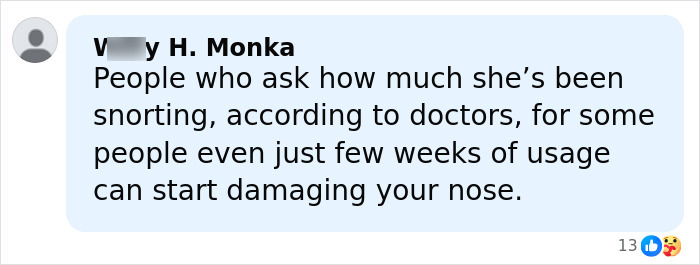 Comment discussing how substance use can damage the nose, related to Paris Jackson's face deformation reveal.