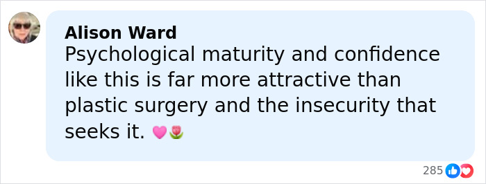 Comment by Alison Ward praising psychological maturity and confidence over plastic surgery, supporting Linda Hamilton's views on aging. Comment by Alison Ward praising psychological maturity and confidence over plastic surgery, supporting Linda Hamilton's views on aging.
