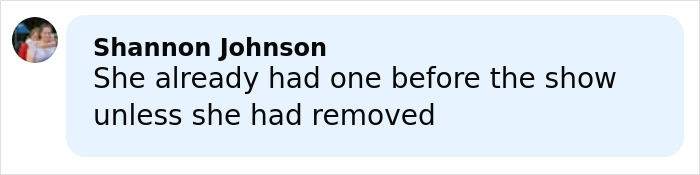 Comment from Shannon Johnson discussing plastic surgery rumors related to LeAnn Rimes after teeth incident on stage.
