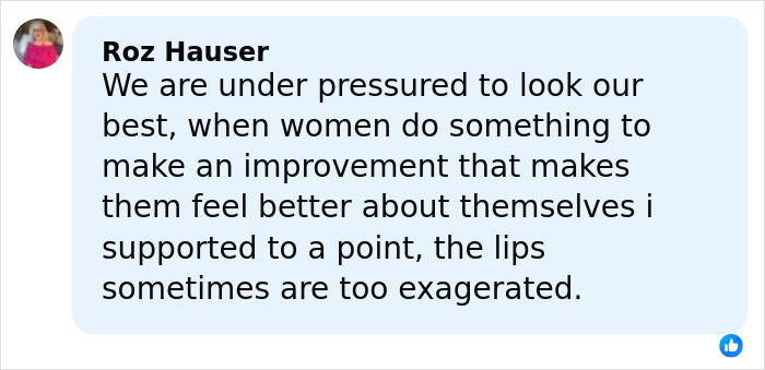 Screenshot of a social media comment discussing pressure on women and exaggerated lips related to plastic surgery rumors.