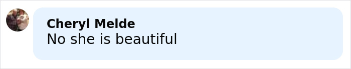 Comment from Cheryl Melde saying no she is beautiful on a light blue background discussing plastic surgery rumors.