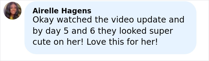 Woman showing new freckles tattooed on her face, with mixed reactions about the impulsive decision and facial changes.