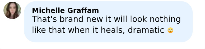 Comment from Michelle Graffam about freckle tattoos, expressing concern over how they will look after healing.
