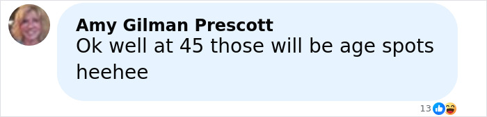 Comment screenshot with a woman discussing age spots, related to freckles tattooed on her face and reactions from others.