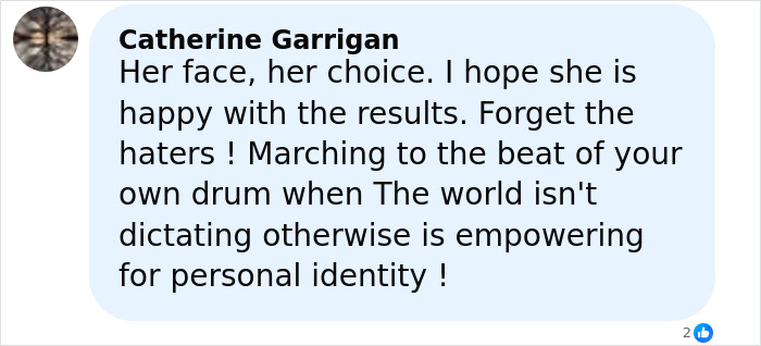 Comment expressing support for woman who impulsively got freckles tattooed and faces criticism about her face appearance.
