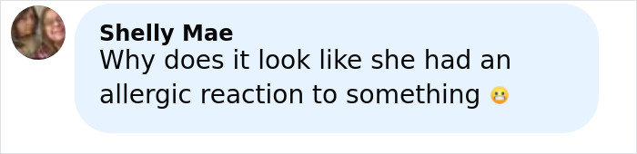 Comment by Shelly Mae questioning if the woman had an allergic reaction after getting freckles tattooed.