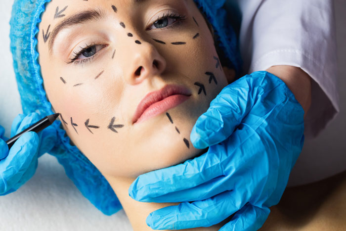 Woman with facial markings for plastic surgery drawn by doctor wearing blue gloves preparing for procedure