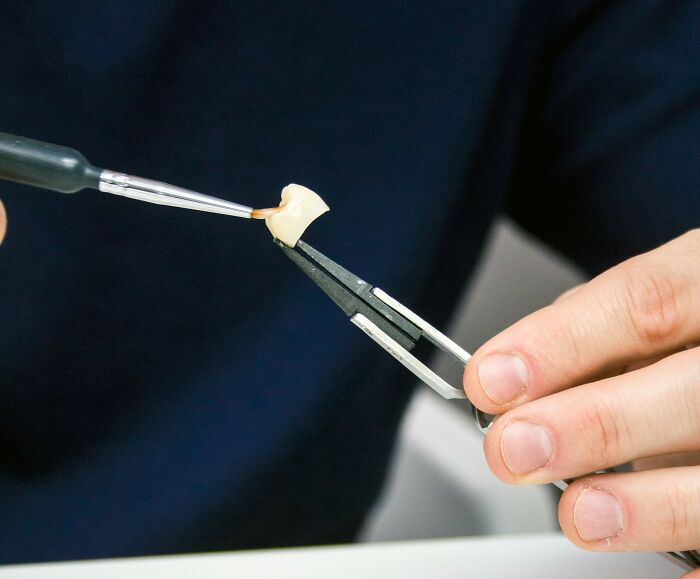 “She Had Mold”: 37 Times Dentists Had To Try Hard Not To Show Their Surprise And Disgust