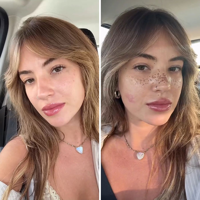 Side-by-side images of a woman before and after getting freckles tattooed on her face, showing the bold new look.