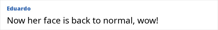 Comment on a forum thread, showing user Eduardo expressing surprise about an actress's face returning to normal after plastic surgery.