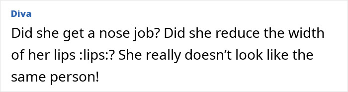 Comment discussing fans divided over plastic surgery clinic sharing unrecognizable before and after pictures of actress.