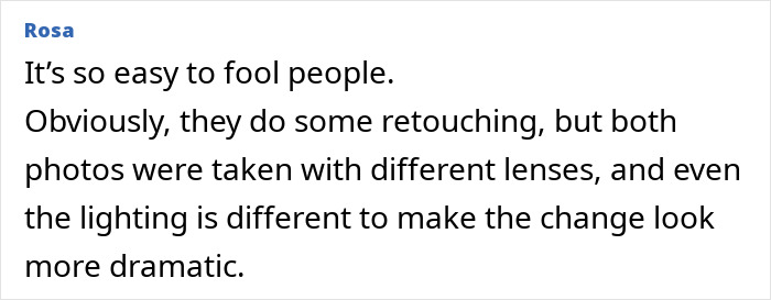 Comment from user Rosa discussing plastic surgery clinic&rsquo;s unrecognizable before and after pictures of actress.