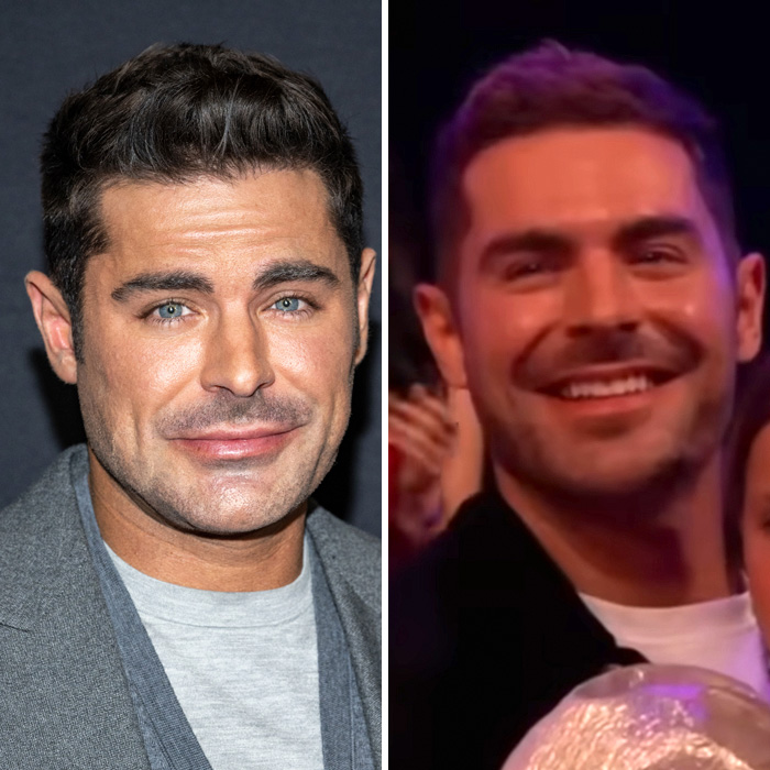 Side-by-side images of Zac Efron showing changes in his back to normal face as experts discuss what happened.