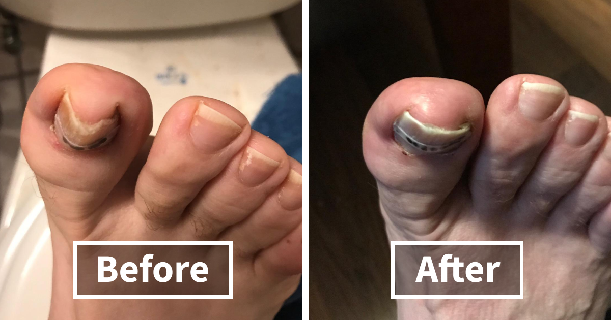 22 Genius Products That Will Solve Your Most Embarrassing Winter Beauty Problems