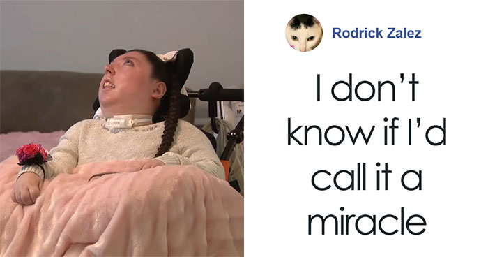 Woman Born Without Most Of Her Brain Turns 20, Family Speaks Out And It Sparks A Heated Debate