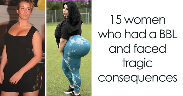 “She Learned Her Lesson”: 15 Times BBL Surgeries Went Horribly Wrong