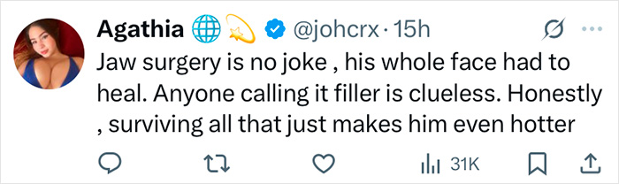 Tweet discussing Zac Efron's back to normal face after jaw surgery, with opinions on his appearance and recovery.