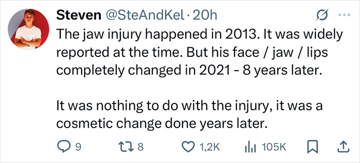 Tweet explaining Zac Efron's back to normal face change, noting cosmetic work years after 2013 jaw injury, with expert commentary.
