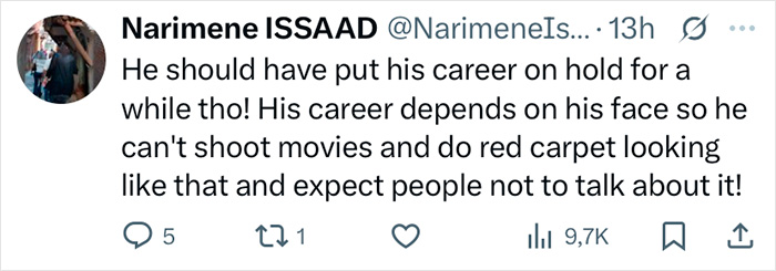 Tweet discussing Zac Efron's back to normal face and public reaction to changes in his appearance.